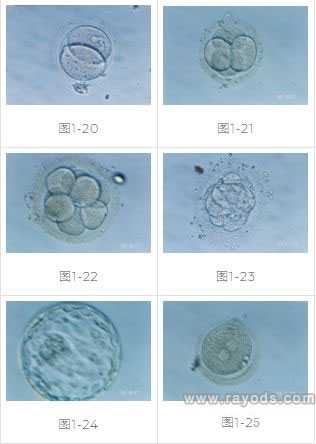 辽宁最大供卵中心_试管婴儿的具体过程！在做试管之前，必须检查六种激素！